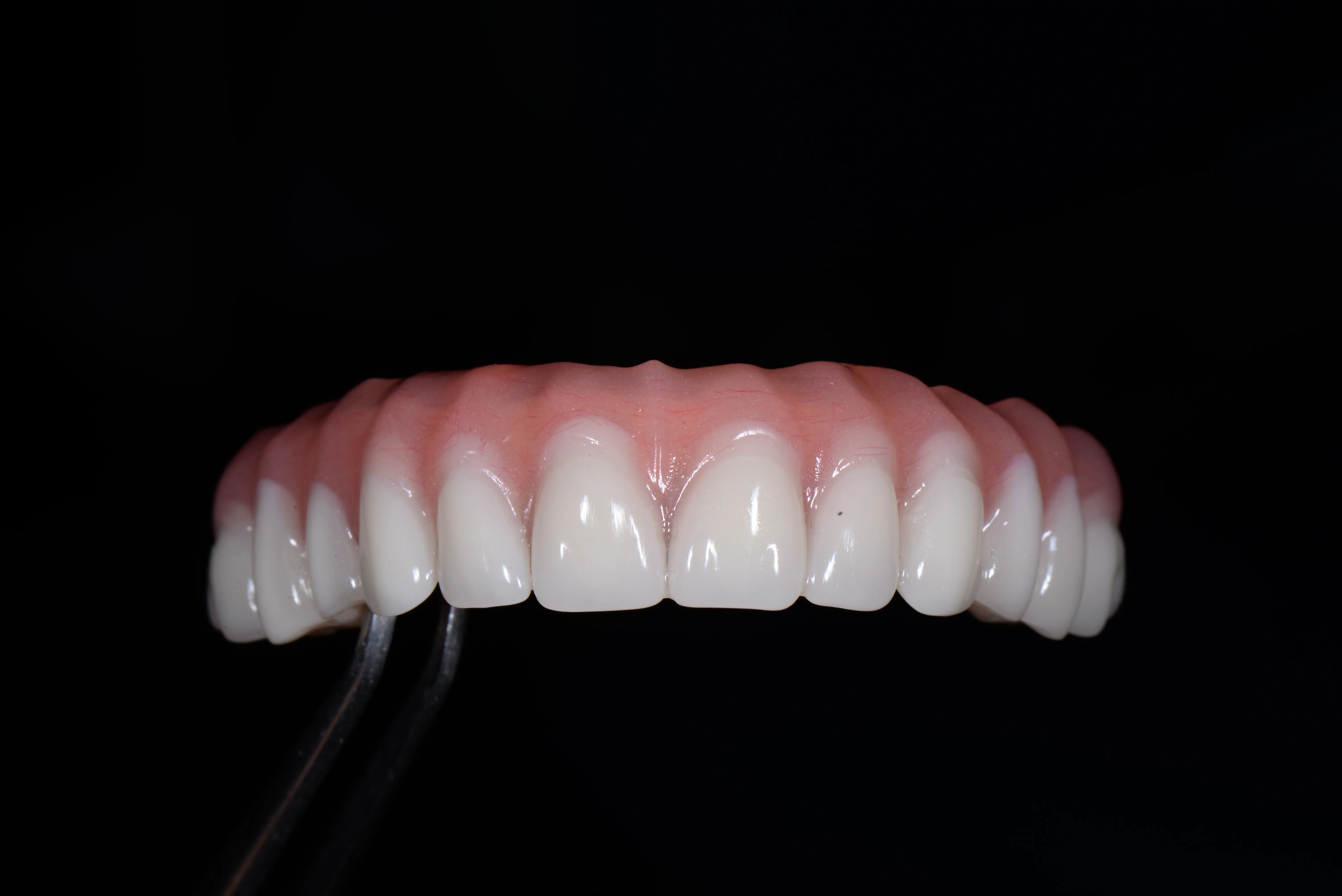 Implant Restorations